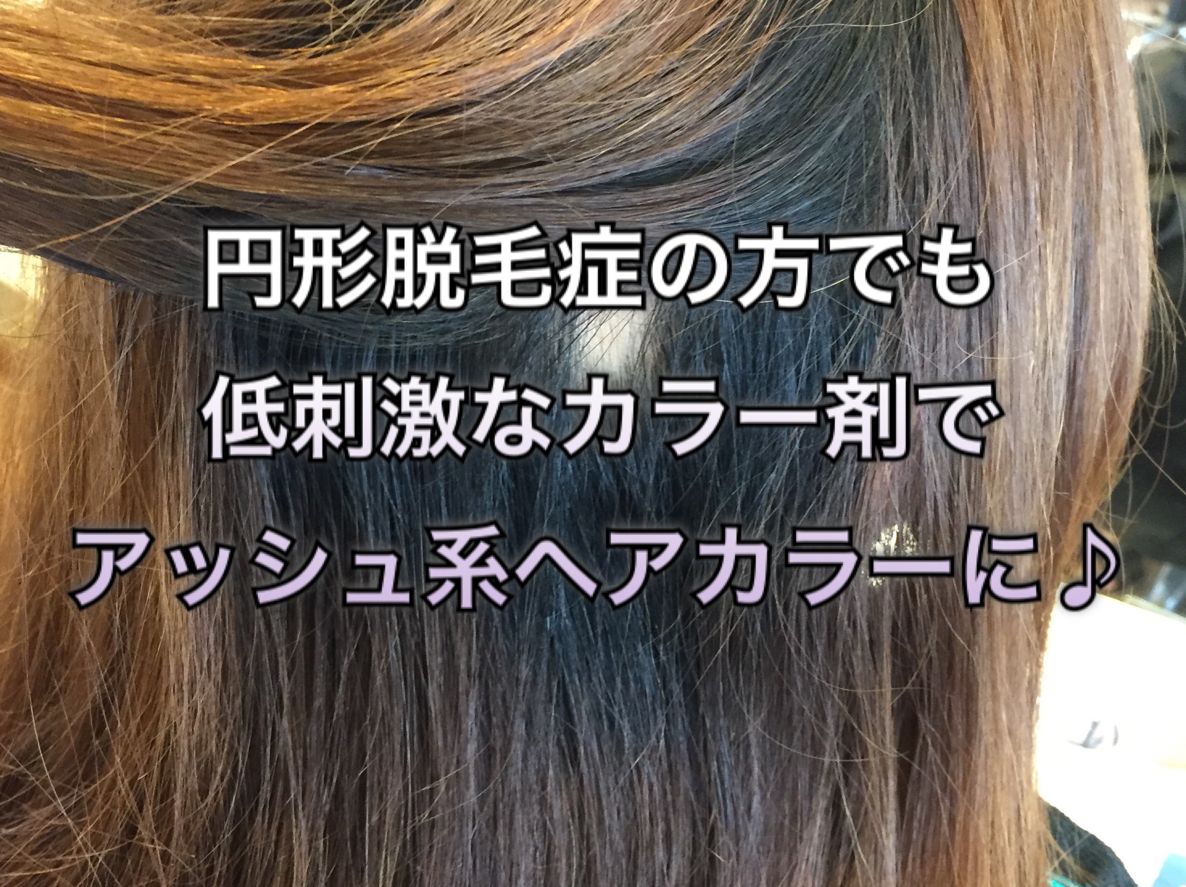 円形脱毛症の方でも低刺激なカラー剤でアッシュ系ヘアカラーに 大阪
