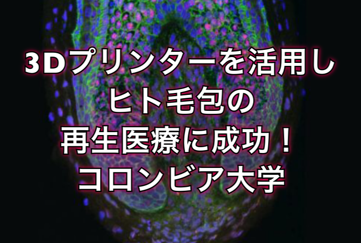 3dプリンターを活用しヒト毛包の再生医療に成功 コロンビア大学 ノンジアミンカラーなど髪と頭皮の悩み解決を得意とする大阪守口千林の美容師あっくんのヘアケアブログ